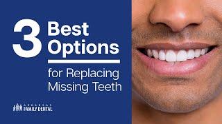 3 Best Options for Replacing Missing Teeth [Episode 1]