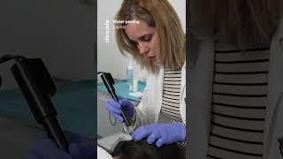 Revitaliza Tu Cabello con Water Peeling Capilar en Clínicas Be | By Dra. Fuensanta Aguilera 