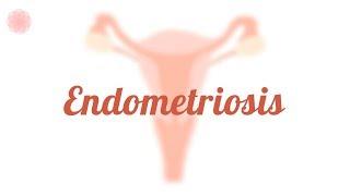 How Endometriosis Affects Fertility