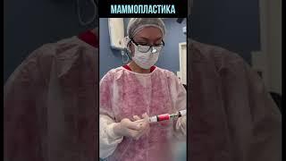 Маммопластика | Увеличение груди имплантами #shorts