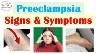 Preeclampsia: Signs & Symptoms You Have To Watch Out For