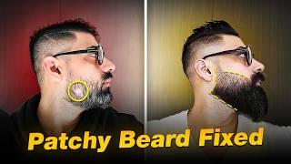 How to fix a patchy beard? Perfect Solution for Beard Growth REVEALED | Beard Growth Formula