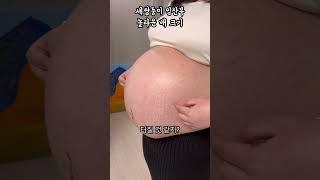 200만뷰세쌍둥이 임산부 배 크기 #shorts #pregnant #triplets #임신 #임신브이로그 #만삭 #임신배크기