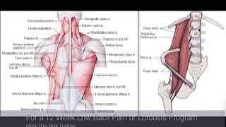 How to Reduce Back Spasms Part 2 of 3