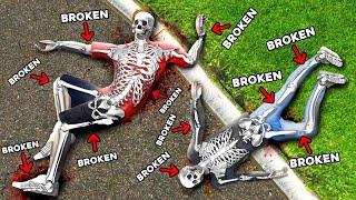 We Broke EVERY BONE in GTA 5 RP.. (Mods)