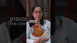 Protect Your Vision with Early Detection | Retinal detachment - Dr. Stuti @shroffeyecentre.official