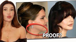 Lana Del Rey Plastic Surgery Update (HIGHLY REQUESTED)