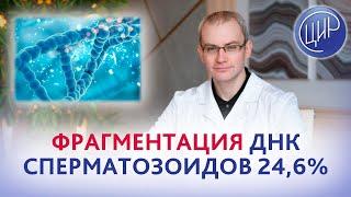 Фрагментация ДНК сперматозоидов 24,6%, морфология по Крюгеру 12% и анэмбриония.