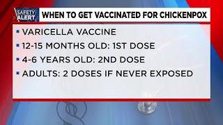 Chickenpox cases rising rapidly in the Upstate