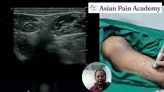 Mastering Sonoanatomy: Gluteal Region Live Demo by Dr. Chinmoy Roy | Asian Pain Academy