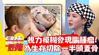 女模視力模糊意外發現腦腫瘤 為生存切除一半「頭蓋骨」？！【#醫師好辣】20220505 part2 EP1326 吳青峰 陳榮堅