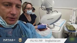 Hair By Dr. Max - ARTAS iX Robotic Hair Restoration: Placing, Fort Lauderdale