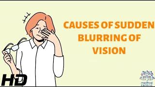 Unveiling the Mystery: The Science Behind Sudden Blurring of Vision