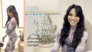 A conversation with Candy on her Breast Implant Explant Journey with Dr. Swistun at LJC