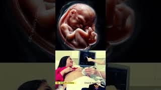From Belly to Heart | Her Reaction to Seeing Baby on USG 