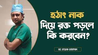 হঠাৎ নাক দিয়ে রক্ত পড়লে কি করবেন? Nose Bleeds