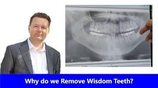 Why do we remove Wisdom Teeth?