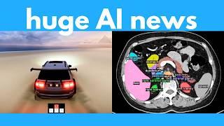 AI full video control, Infinite 3D worlds, AI finds cancer, FLUX tools, Open-source model beats o1