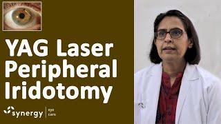 Laser Iridotomy for Glaucoma | Yag Laser Pi (Peripheral Iridotomy)