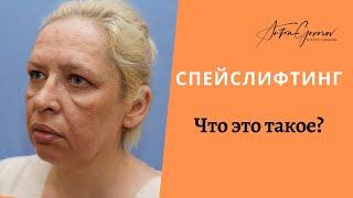 Что такое спейслифтинг?