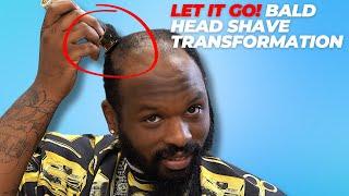 Let It Go! Knowing When to Go Bald!