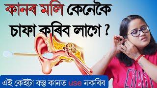 কানৰ মলি বা Ear Wax কেনেকৈ চাফা কৰিব || Cleaning  Your Ear Wax correctly || Ponkhi Sharma