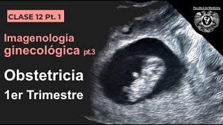 12.1 -  Imagen en Obstetricia 1er Trimestre