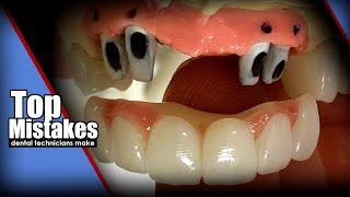 Top Mistakes Dental Technicians Make Episode 1