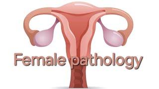 Female pathology 4th lecture.