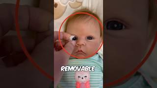 This Baby's Eyes Are Artificial