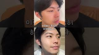 하얀피부 연예인들 사이 유행이라는 미백제품 #미백 #앰플 #미백앰플 #미백크림 #추천