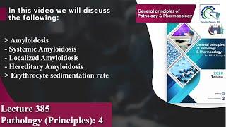 Amyloidosis | Erythrocyte sedimentation rate