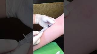 How to Take Venous Blood Sample | Venipuncture