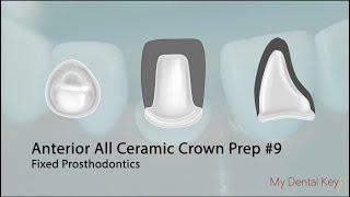 PASS THE CDCA - All Ceramic Anterior Crown Preparation | My Dental Key