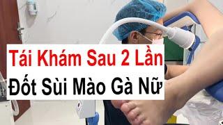 Thực Hiện Tái Khám Sau 2 Lần Điều Trị Sùi Mào Gà Nữ Bằng Dao Điện | Bác Sĩ Sắc