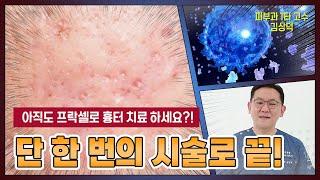 패인 흉터&위축성 흉터 치료 안전하게 한 번에 끝!_feat.국내 유일 특허 비앤씨 김상덕 원장