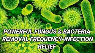 POWERFUL FUNGUS & BACTERIA REMOVAL FREQUENCY - Infection Relief Frequency Binaural Beats