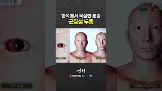 눈이 빠질듯이 고통스러운 군발두통