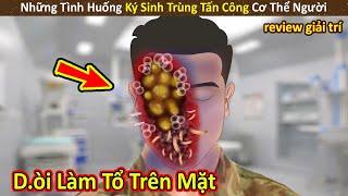 Nhím Cute Review Những Trường Hợp Con Người Bị Ký Sinh Trùng Xâm Nhập P33|| Review Giải Trí Đời Sống