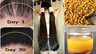 15 Days Challenge  - Extreme Hair Growth | World's Best Faster Remedy for Hair Growth