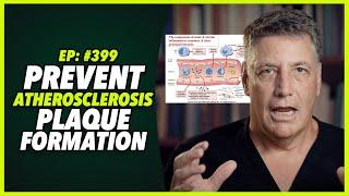 Ep:399 PREVENT ATHEROSCLEROSIS PLAQUE FORMATION