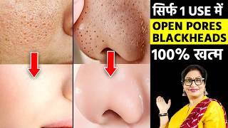 खर्चा सिर्फ 5/- रुपए, हफ्ते में 3 दिन लगा लो, फेशियल से 10 गुना ज्यादा निखार Multani Mitti Face Pack
