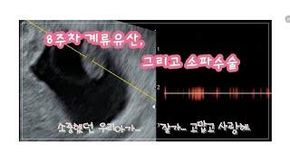 [반팔십 임산부 이야기]-8주차, 계류유산... 그리고 소파수술
