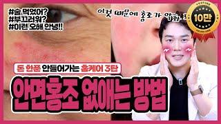 돈안들이고 안면홍조 없애는법 8가지 방법 "홍조도 피부과 말고 이제는 집에서 해결!"