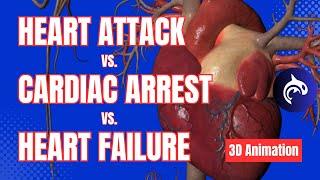 The Difference Between Cardiac Arrest, Heart Attack, and Heart Failure - 3D Animation