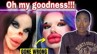 Six times plastic surgery went horribly wrong  Reaction video