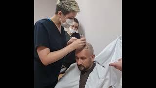 Proceso de pre operatorio de Implante Capilar en Paciente