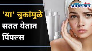 ५ चुका ज्यामुळे सतत चेहऱ्यावर पिंपल्स | Avoid these 5 Mistakes to get rid of Pimples