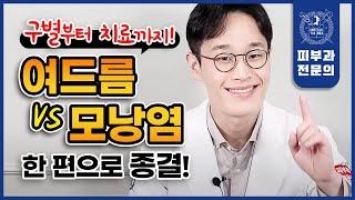 여드름 vs. 모낭염 이렇게 구분하세요 | 원인 구별법 치료 관리법까지 한 큐에 정리!