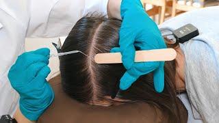 ASMR Perfectionist SCALP Check with BAD Results and TREATMENT (Real Person)